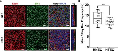 Susceptibility of Human Airway Tissue Models Derived From Different Anatomical Sites to Bordetella pertussis and Its Virulence Factor Adenylate Cyclase Toxin